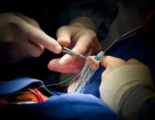 Heart Valve Surgery service image